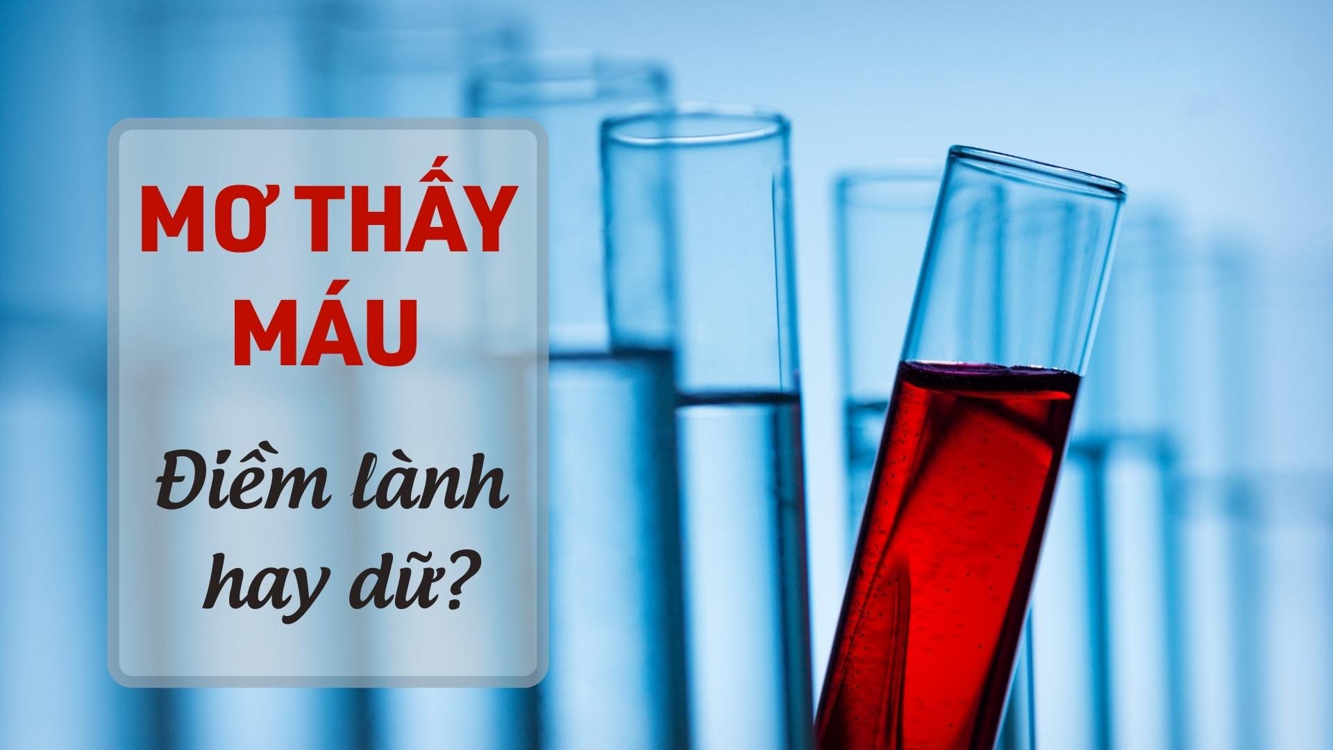 Mơ thấy máu là điềm lành hay dữ, cần làm gì để tránh rủi ro?